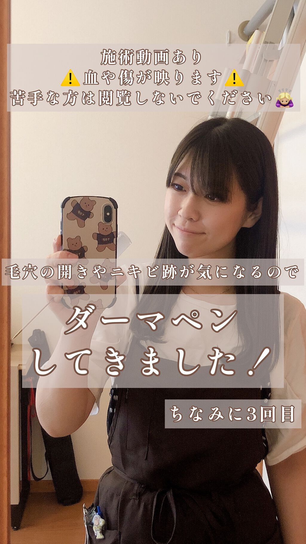 試してみた ダーマペン ダーマスタンプ Mym Lips