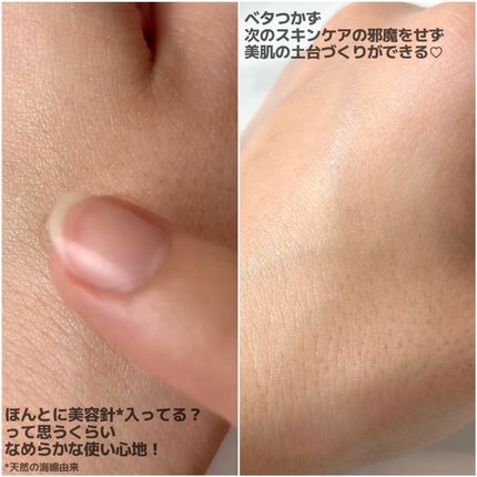 マイクロダーマブースター/XOUL/美容液を使ったクチコミ(3枚目)