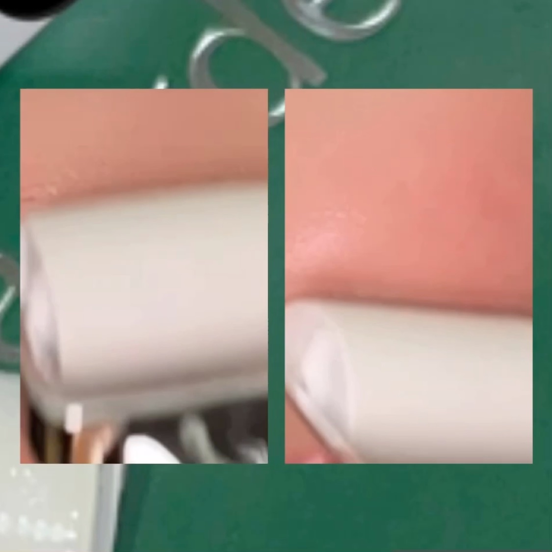 ダーマトックスニードルショット/Easydew/その他スキンケアの動画クチコミ4つ目