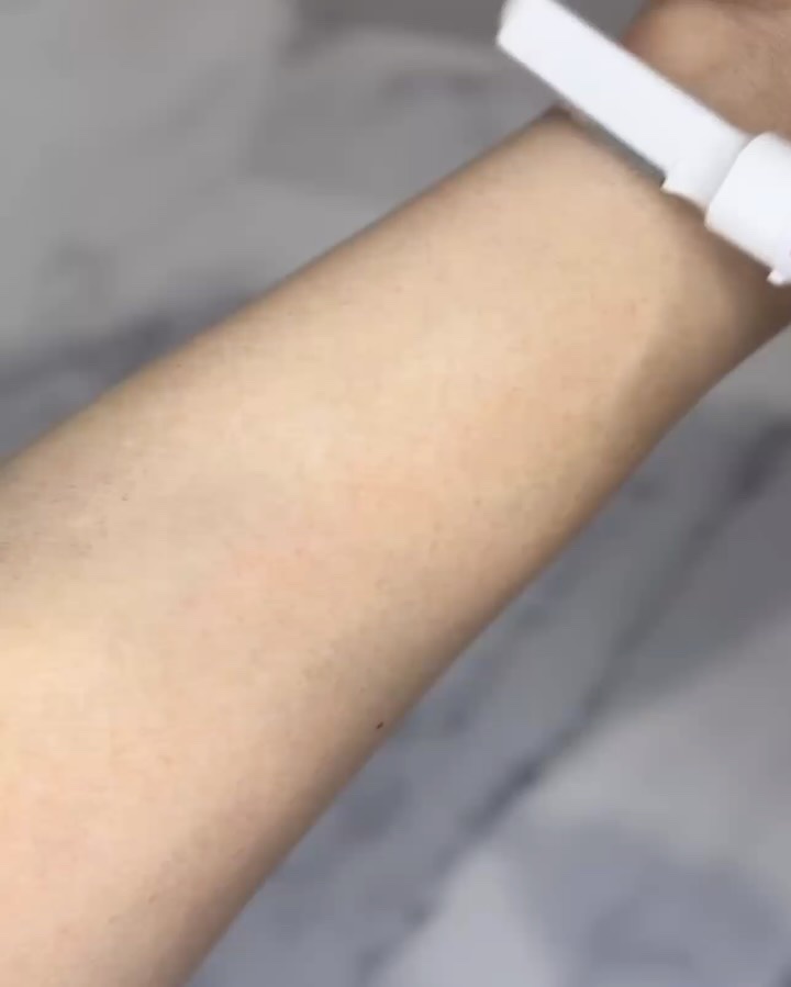 LINKAフレアタッチ プロ/LINKA/家庭用脱毛器を使ったクチコミ（3枚目）