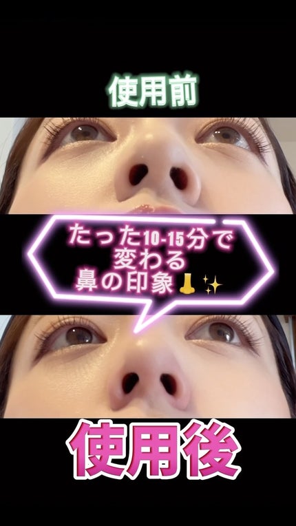 試してみた】Fornez(フォーネス) LUXCEARのリアルな口コミ 試してみた】Fornez(フォーネス) LUXCEARのリアルな口コミ