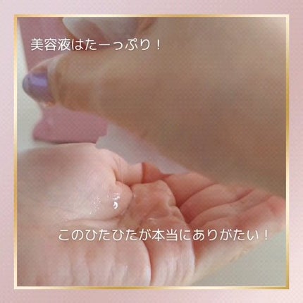 ルルルンピュア エブリーズ/ルルルン/シートマスク・パックを使ったクチコミ(2枚目)