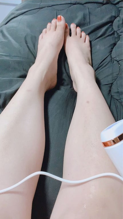 Richesse9 IPL光脱毛器/Richesse9(リシェスナイン)/家庭用脱毛器を使ったクチコミ(2枚目)