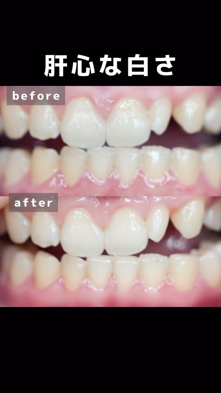 ホワイトパープル歯みがき ピーチフローラルミントの香り/EUTHYMOL/歯磨き粉の人気ショート動画