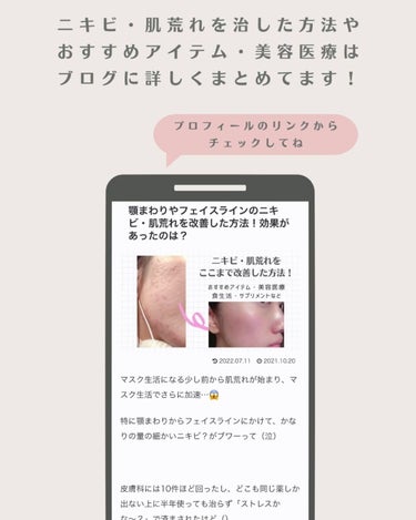 なーこ🫧ニキビ・肌荒れを美肌に on LIPS 「ボディミスト、香水、ハンドクリーム…香りアイテムって常に持って..」（6枚目）