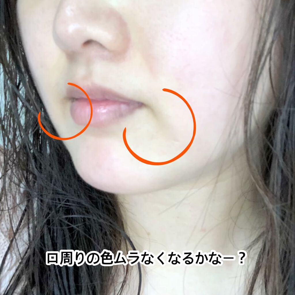 スキンライトセラピーII/Makeon/美顔器・マッサージを使ったクチコミ（2枚目）