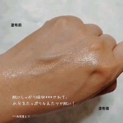 アットクリニック ハイパーPトーニング美容液/DOMINAS/美容液を使ったクチコミ(5枚目)