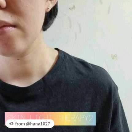 スキンライトセラピーII/Makeon/美顔器・マッサージを使ったクチコミ(7枚目)