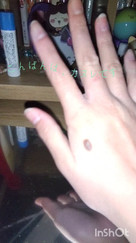 を使ったクチコミ（1枚目）