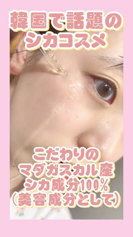 センテラ アンプル/SKIN1004/美容液の人気ショート動画