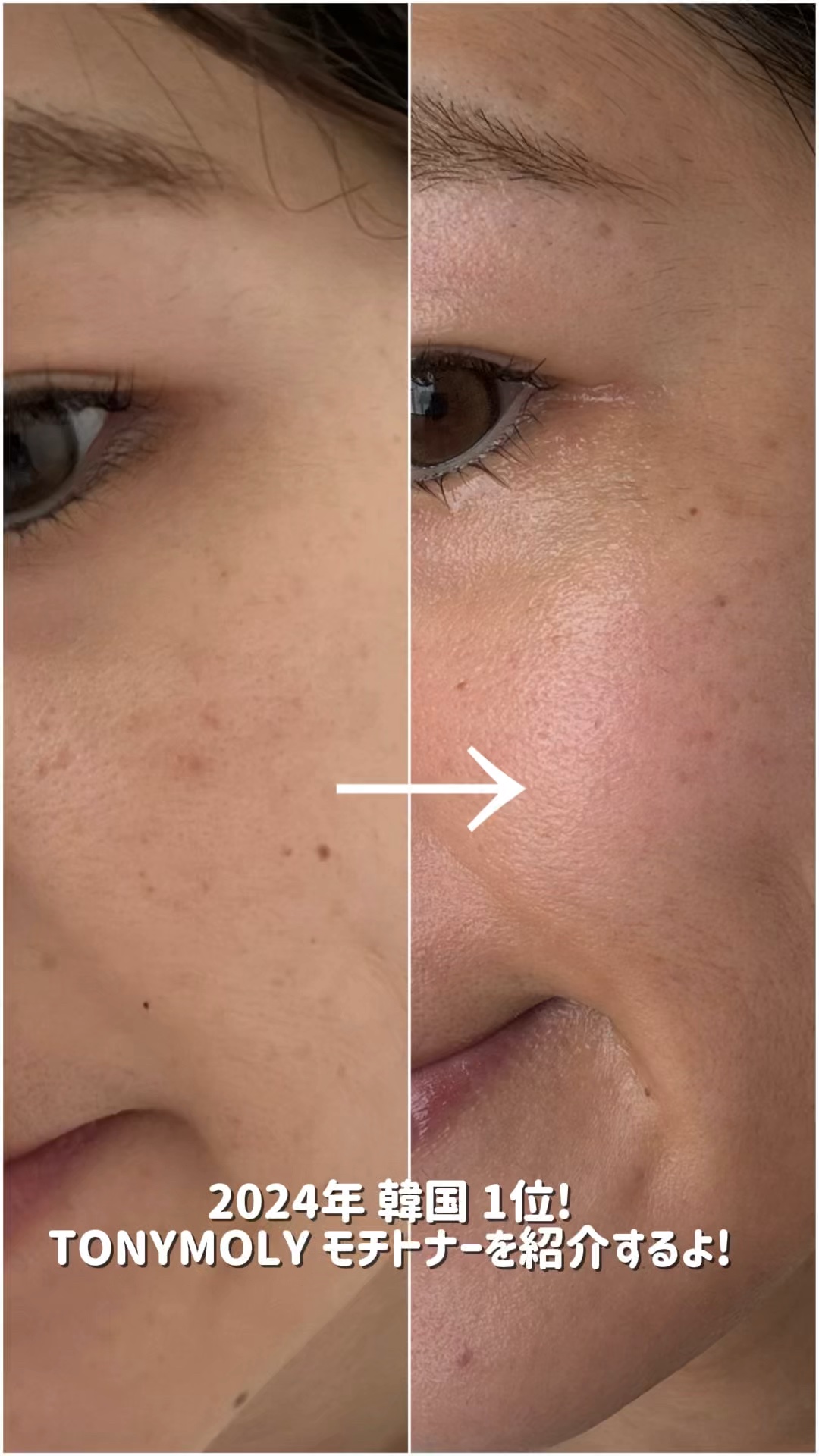 Wonder Ceramide Mochi Toner（トニーモリーワンダーCモチトナー）/TONYMOLY/化粧水の人気ショート動画