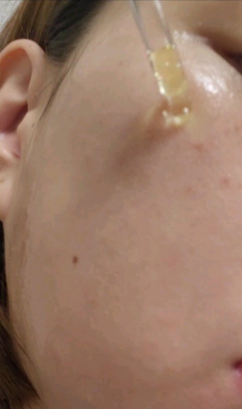 グルタ ビタミンC トーニング アンプル/IOPE/美容液を使ったクチコミ（3枚目）