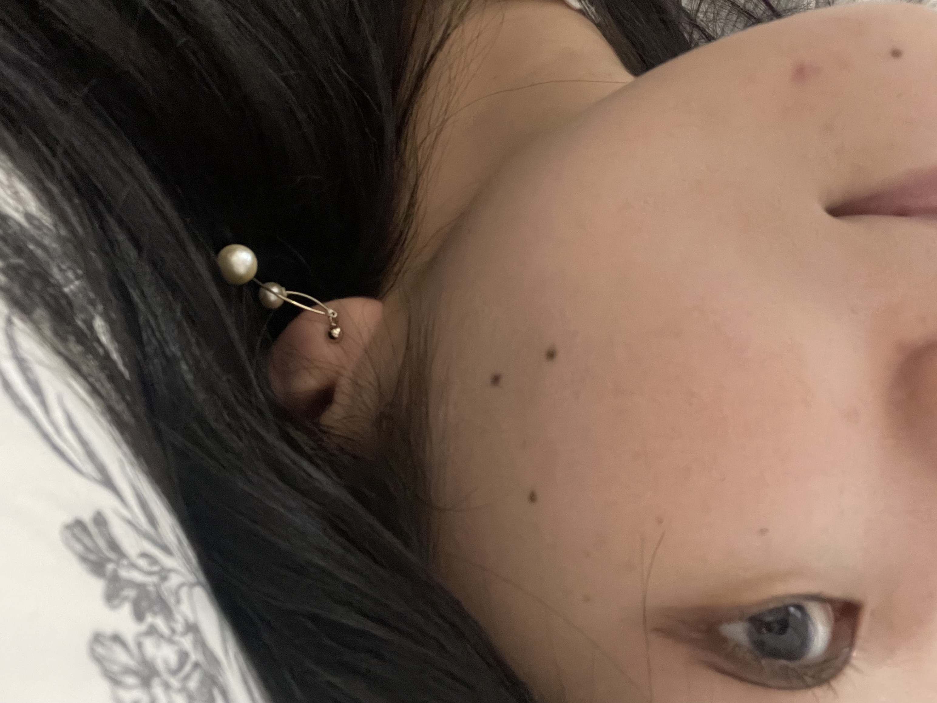 ブスならせめて美肌になりたい