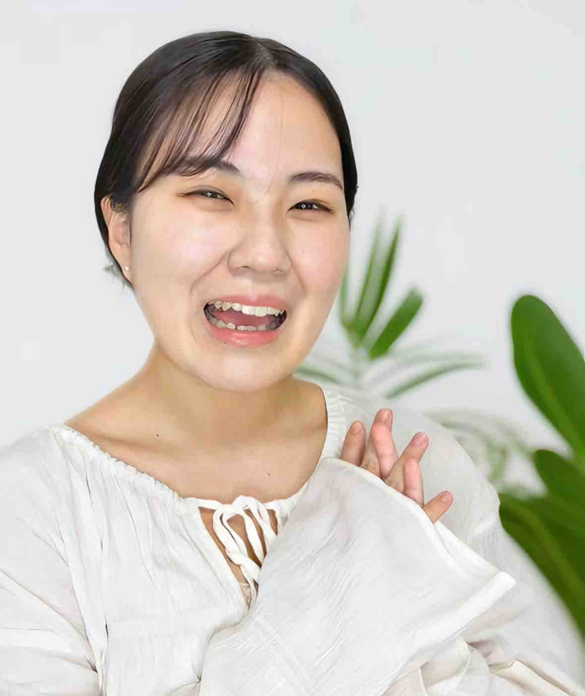 ニキビを諦めかけた人の味方｜エマ🫧