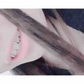 ちゃんみ